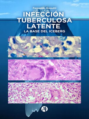 cover image of Infección Tuberculosa Latente, la base del iceberg
